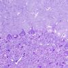 10A1 Artifact - Dark Cell Change cerebellum (Mouse 3) Plastic 1