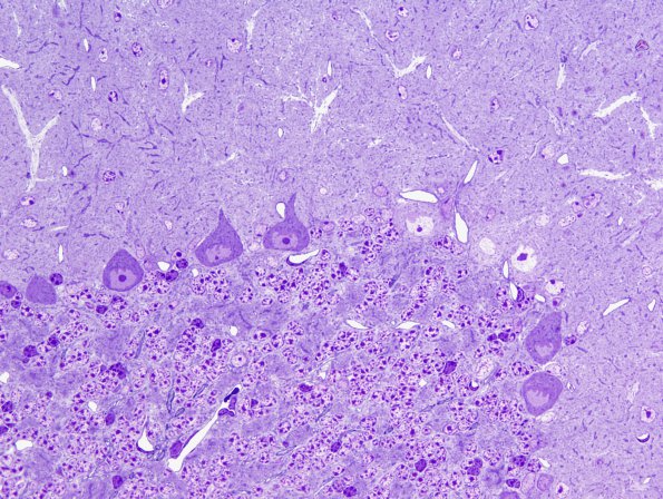 10A1 Artifact - Dark Cell Change cerebellum (Mouse 3) Plastic 1