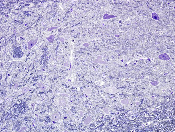 10A2 Artifact - Dark Cell Change 2 (Mouse Cerebellar deep nuclei) 8