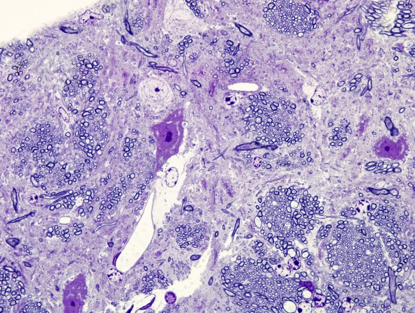 11 Artifact - Dark Cell Change basal ganglia (Mouse 5) Plastic 1