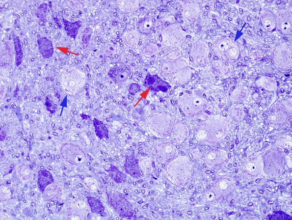 12 Artifact - Dark Cell Change 2 (Rat Sympathetic Mesenteric Ganglion 1) 1