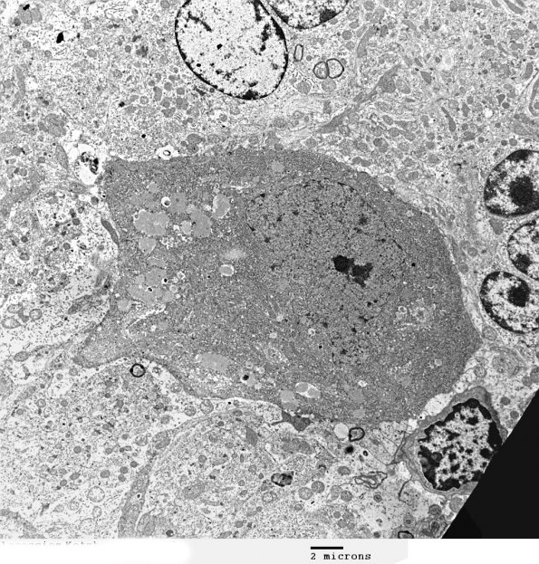 15A1 Artifact - Dark Cell Change Purkinje (Mouse 2) EM 1