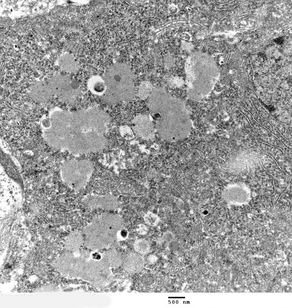 15A2 Artifact - Dark Cell Change Purkinje (Mouse 2) EM 2