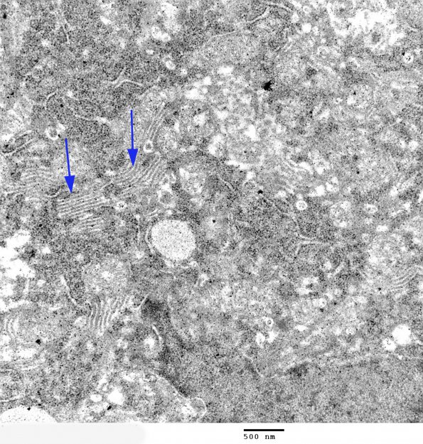 15A3 Artifact - Dark Cell Change Purkinje (Mouse 2) EM 3 - Copy