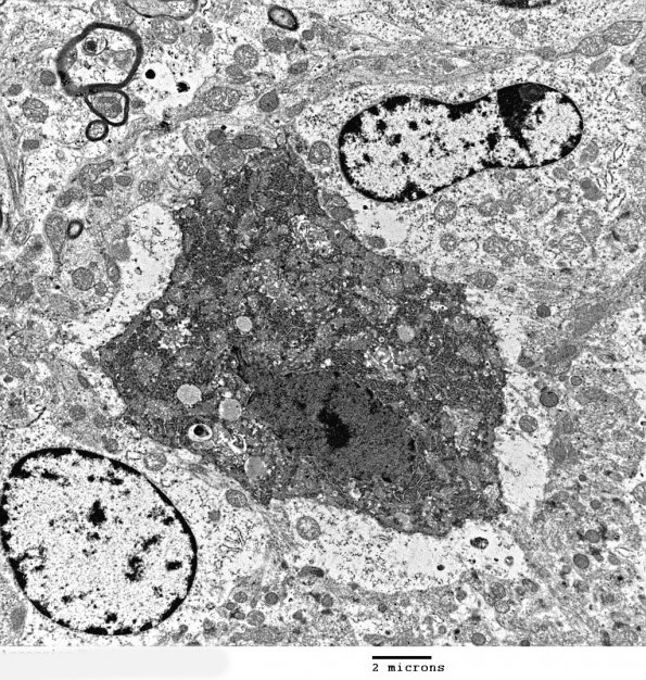 15A4 Artifact - Dark Cell Change Purkinje cell (Mouse 2) EM 005