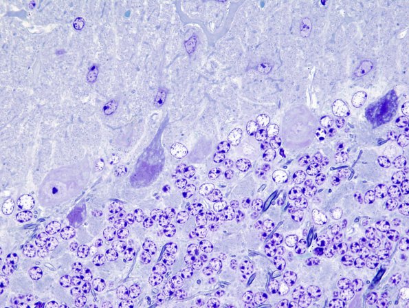 9A1 Artifact - Dark Cell Change Cerebellum (Mouse 1) 3