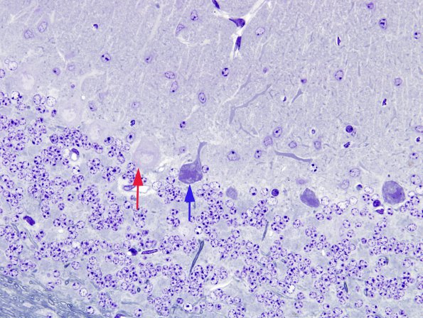 9A2 Artifact - Dark Cell Change Cerebellum (Mouse 1) 5