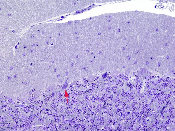 9A3 Artifact - Dark Cell Change Cerebellum (Mouse 1) 6