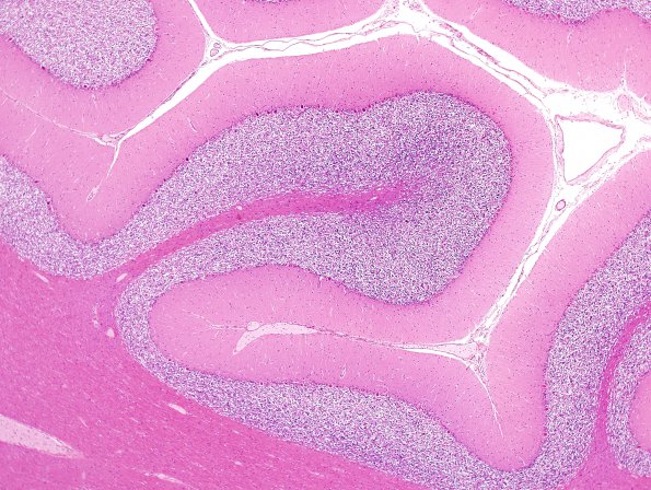 1B2 Artifact, autolysis, Etat Glace (Case 8) N9 Area 1 H&E