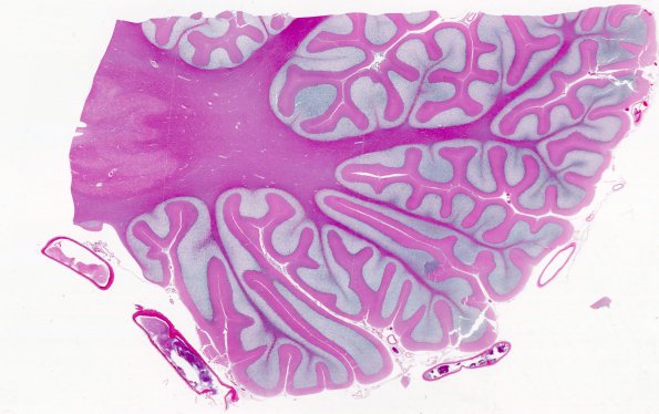 3A1 Artifact, autolysis, Etat Glace (Case 4) H&E 1 whole mount