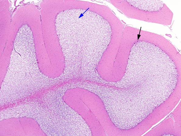 3A2 Artifact, autolysis, Etat Glace (Case 4) H&E 1