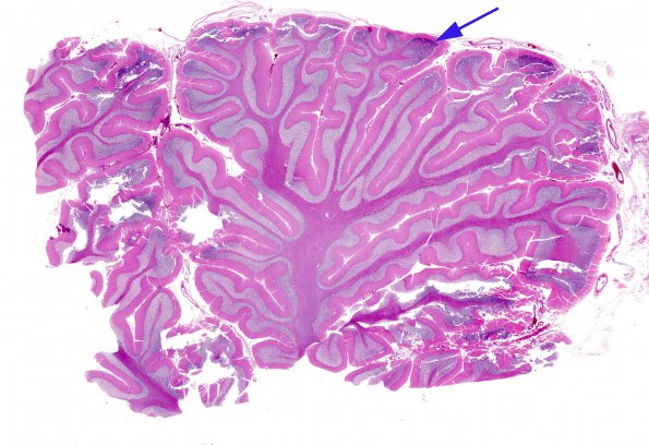 4 Artifact, autolysis, Etat Glace (Case 1) H&E 1 whole mount