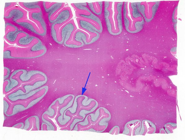 5 Artifact, autolysis, Etat Glace (Case 3) H&E whole mount