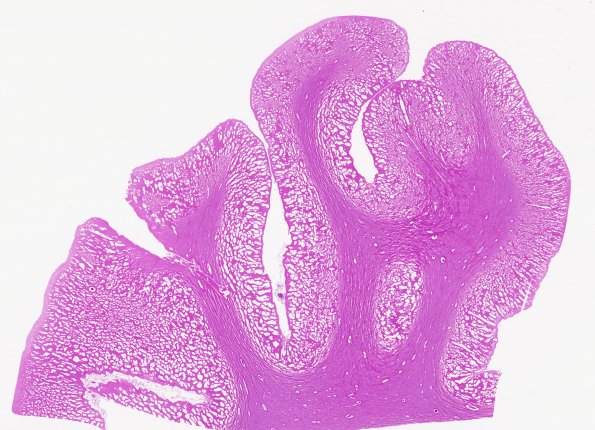 2A1 Artifact, freeze-thaw, FTLD (Case 1) L2 H&E 1 whole mount