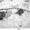 1A5 Artifact, nuclear, mimics viral inclusion (Case 1) EM 068 - Copy