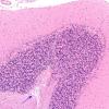 1B4 Artifact, terminal Clostridium sepsis (Case 1) H&E 2