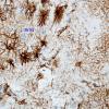 1A4 Astrocytes, GM-WM Junction (Case 20) GFAP 4