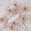 2A7 Astrocytes, WM (Control, Case 3) GFAP 18