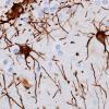 2A8 Astrocytes, WM (Control, Case 3) GFAP 24