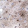 3A1 Astrocytes, GM (Case 9) 1