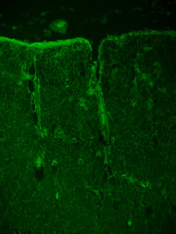 3A3 Astrocytes, GM (Control cortex) GFAP fluorescence