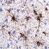 3A4  Astrocytes, WM (Case 9) GFAP 1