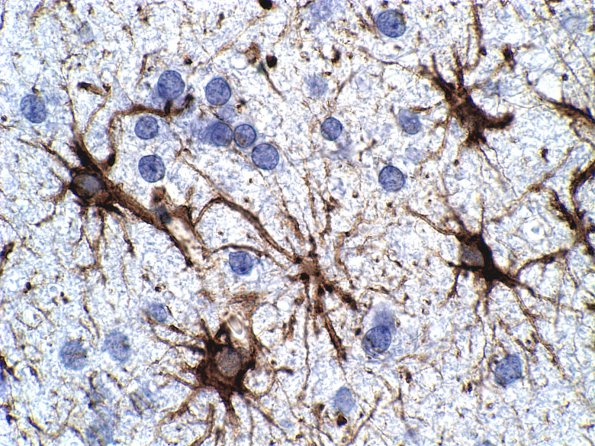 3A5 Astrocytes, WM (Case 9) GFAP 4