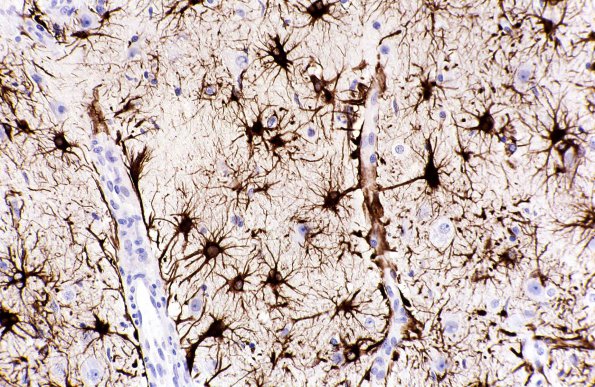 4A2 Astrocytes, GM GFAP 1