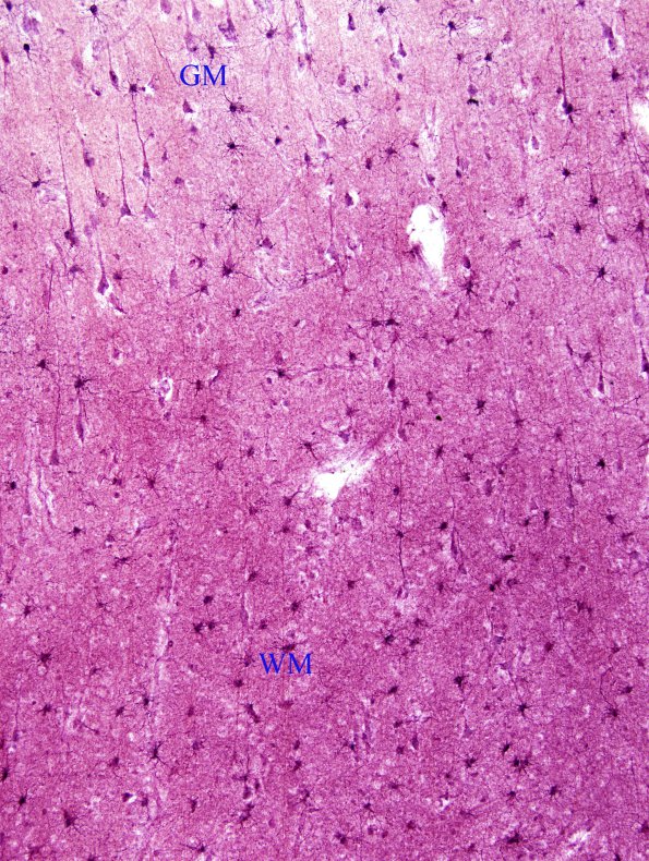 1A1 Astrocytes, Junction GM-WM (Cerebral Cortex) Cajal AuCl stain