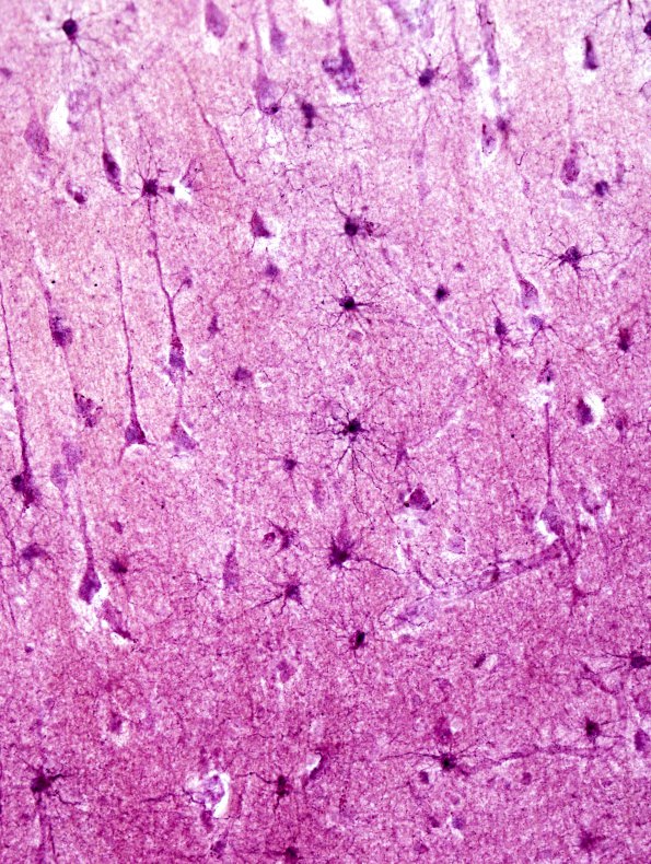 1A2 Astrocytes, GM (Cerebral Cortex) Cajal AuCl stain 1