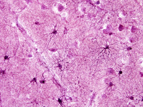 1A3 Astrocytes, GM (Cerebral Cortex) Cajal AuCl stain 2