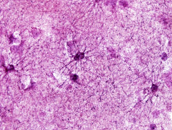 1A4 Astrocytes, GM (Cerebral Cortex) Cajal AuCl stain 3