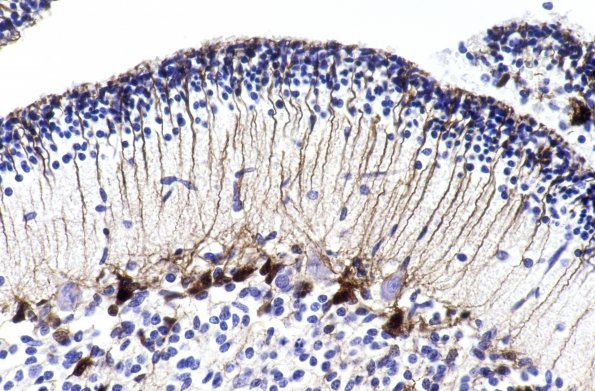 1A2 Astrocytes, radial glia (Case 1) GFAP 2 A