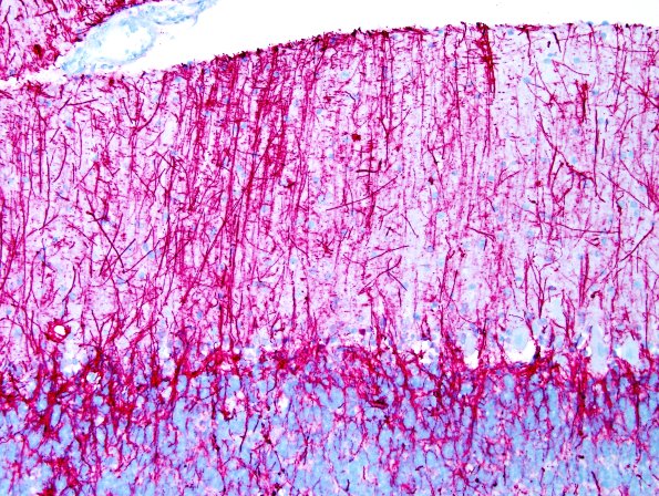 2A2 Radial Glia, Bergmann (Control, Case 4) GFAP 2A