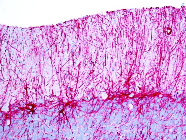 2A3 Radial Glia, Bergmann (Control, Case 4) GFAP 1A