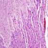 2A3 Brainstem, neonate, V Nerve (Case 2)  H&E 2