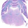 2B1 Brainstem, neonate, V Nerve (Case 2)  LFB-PAS 1