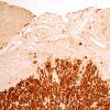 6C2B-Root-entry-zone-Case-6-N8-LS-PLP-20X.jpg