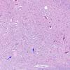 3A1 Central chromatolysis (Case 3) N10 H&E 1