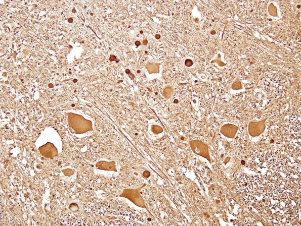 9 Central Chromatolysis NF 3