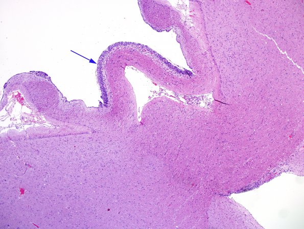 1A1 Circumventricular Organ (CVO, ZOO Jaguar) H&E 2