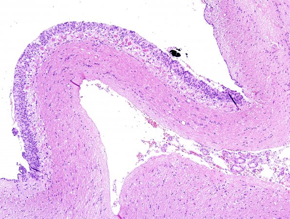 1A2 Circumventricular Organ (CVO, ZOO Jaguar) H&E 3