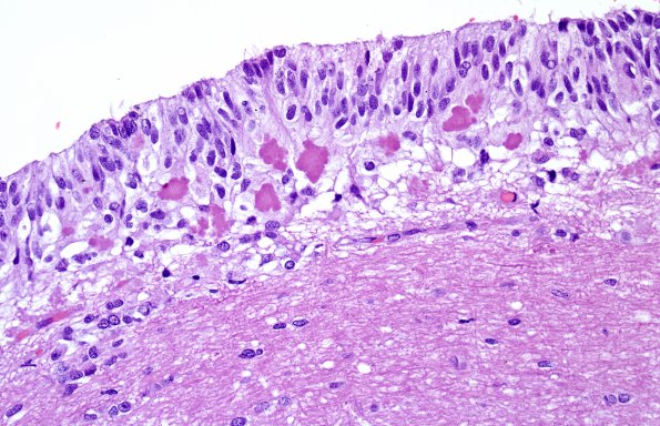 1A3 Circumventricular Organ (CVO, ZOO Jaguar) H&E 4