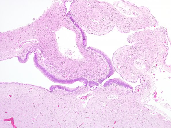 2A1 Circumventricular organ (CVO, Zoo Okapi) H&E 1