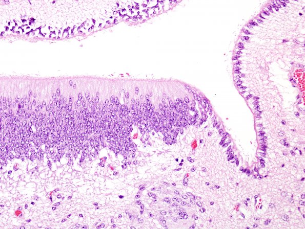 2A3 Circumventricular organ (CVO, ZOO Okapi) H&E 3