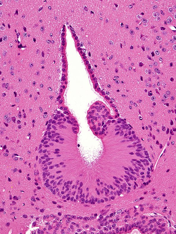 3A1 Subcommissural organ, rat H&E 1