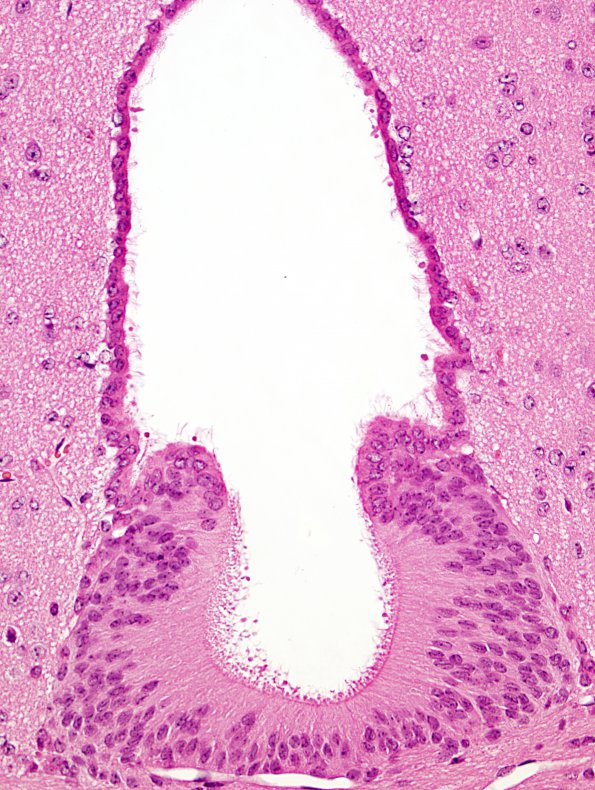 3A2 Subcommissural organ, rat H&E 2