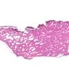 1A3 Bone formation, dura (Case 1) H&E whole mount