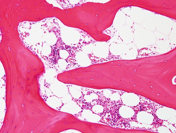 2A4 Bone formation, dura (Case 2) H&E 3.