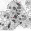 1A3 Endothelium, Weibel-Palade Bodies (Case 1) Skin EM 029